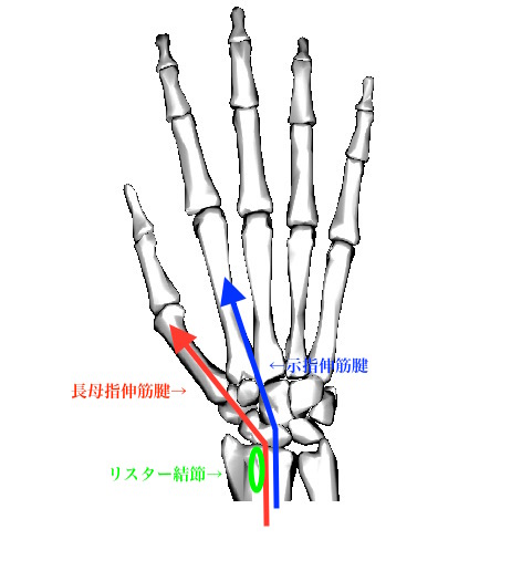 リスター結節ー長母指伸筋腱